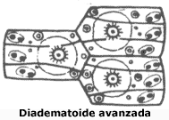 Placas de tipo Diadematoide Avanzada